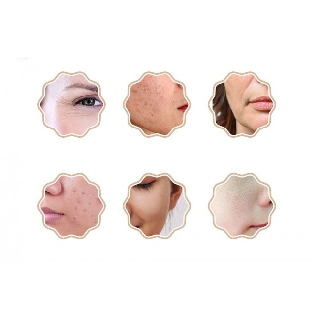Уред за лице и тяло ANLAN 01-AGZMZ21-04E Waterproof mask with light therapy - Маска за лице
