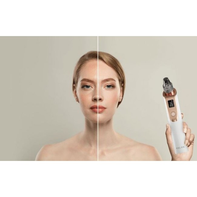 Уред за лице и тяло ANLAN X7 blackhead remover ALHTY03-01R Уред за премахване на черни точки